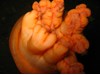 Photo of Metridium farcimen